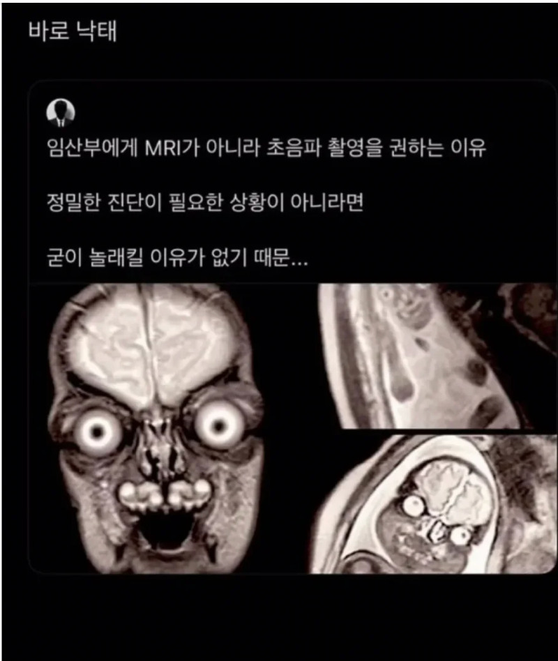 스크린샷 2026-03-17 오후 8.41.54.png